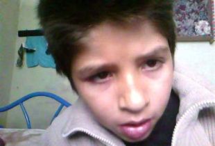 Ulises Gabriel Pérez, el niño de 14 años que murió en el Hospital en un supuesto caso de mala praxis.